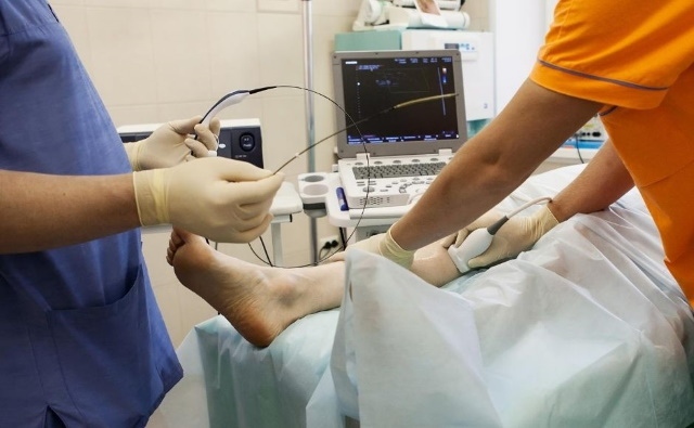 Laserowe usuwanie żylaków